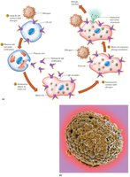 Immediate-reaction allergy