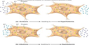 Cellular shifts of H+ and K+ in acidosis and alkalosis
