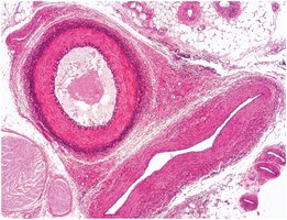 Photomicrograph of a muscular artery and the corresponding vein in cross section