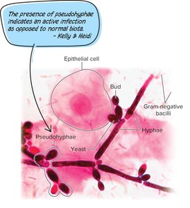 Microscopic image showing pseudohyphae of Candida albicans