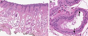 Histology of ceruminous gland