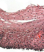 Stratified squamous epithelium