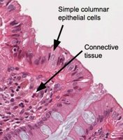 Simple columnar epithelial cells and connective tissue