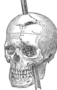 Prefrontal cortex and personality