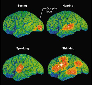 Brain activity during seeing, hearing, speaking, and thinking