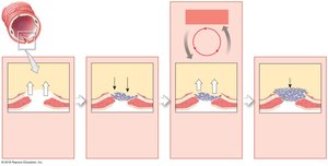 Positive feedback: blood clotting process