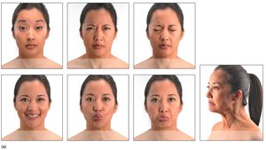 Actions of select facial muscles