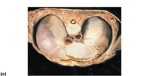Diaphragm inferior view