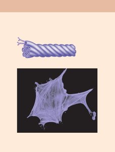 Intermediate filaments