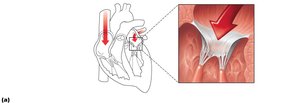 AV valve function and anatomy