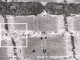 Cardiac muscle fiber electron micrograph