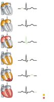 Sequence of depolarization and repolarization related to ECG
