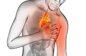 Person clutching chest, representing angina pectoris