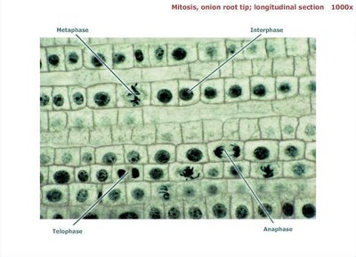 Onion root tip mitosis stages labeled