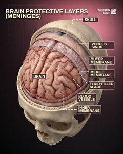 Brain protective layers (meninges)