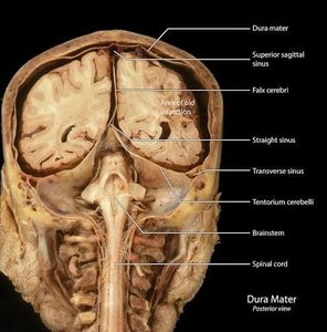 Venous sinuses of the brain