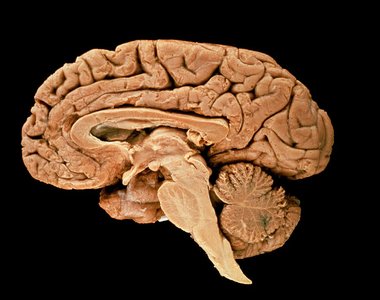 Sagittal section of the brain showing the cerebellum