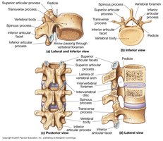 Anatomy of vertebrae: lateral, inferior, and posterior views