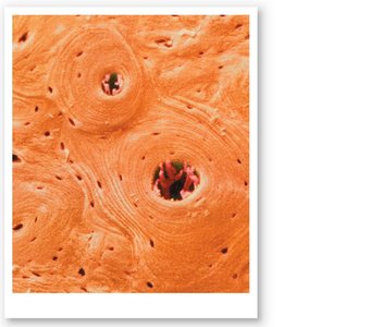 Osteons of Compact Bone