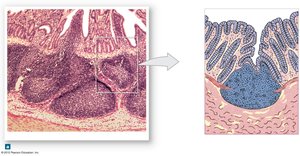 Aggregated lymphoid nodules in intestine