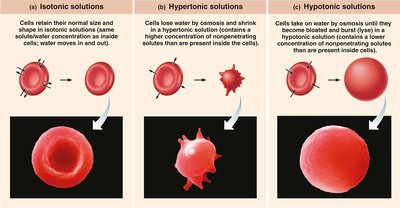 Effect of solutions of varying tonicities on red blood cells