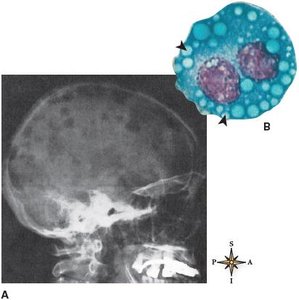 Phagocytosis by neutrophil
