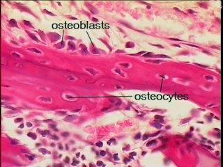 Histology of bone showing osteoblasts and osteocytes