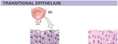 Transitional epithelium