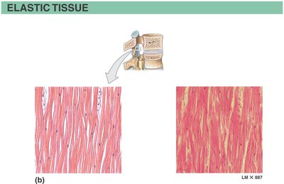 Elastic connective tissue