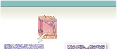 Dense irregular connective tissue
