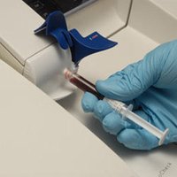 Arterial blood gas sampling