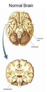Normal brain anatomy