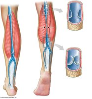 Diagram showing function of venous valves in the leg