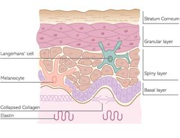 Langerhans cell and melanocyte in epidermis