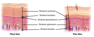 Comparison of thick and thin skin layers