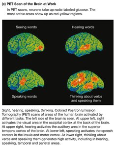 PET scan of the brain at work during language tasks