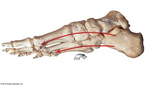 Arches of the foot
