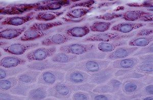 Histological image of epidermal layers