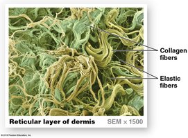 Reticular layer of dermis