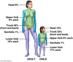 Rule of nines for burn assessment