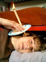 Ear candling procedure