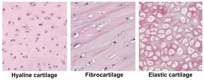 Histology of hyaline, fibrocartilage, and elastic cartilage