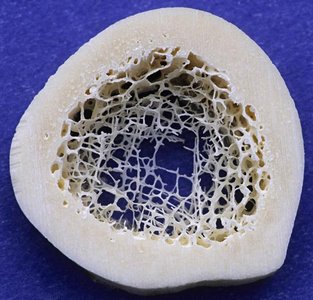 Cross-section of bone showing spongy bone