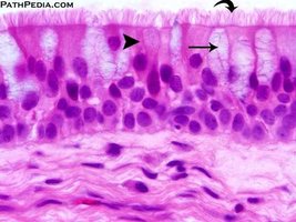 Photomicrograph of pseudostratified ciliated columnar epithelium