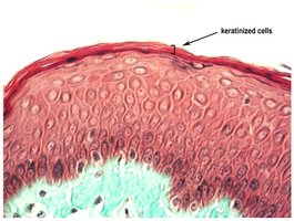 Photomicrograph of keratinized stratified squamous epithelium