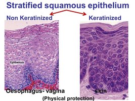 Comparison of keratinized and non-keratinized stratified squamous epithelium