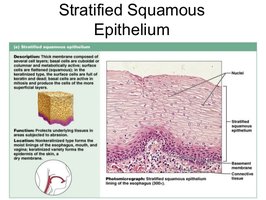 Photomicrograph of non-keratinized stratified squamous epithelium