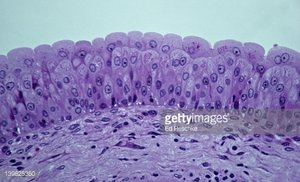 Photomicrograph of transitional epithelium