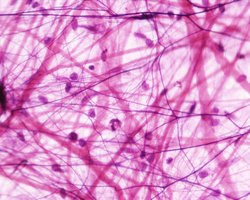 Photomicrograph of areolar connective tissue
