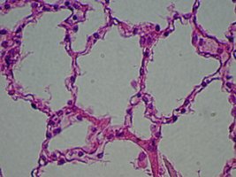 Photomicrograph of simple squamous epithelium in alveoli of the lungs